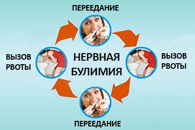 Лечение булимии в Большой Глушице